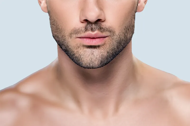 Jaw-definition