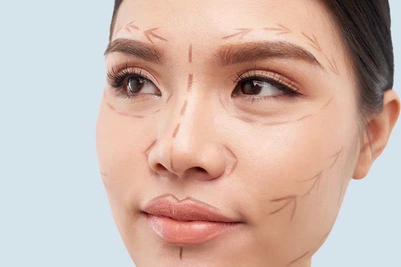 Minilipo-+-1-Nanofat-Filler