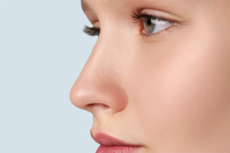 Nose-correction