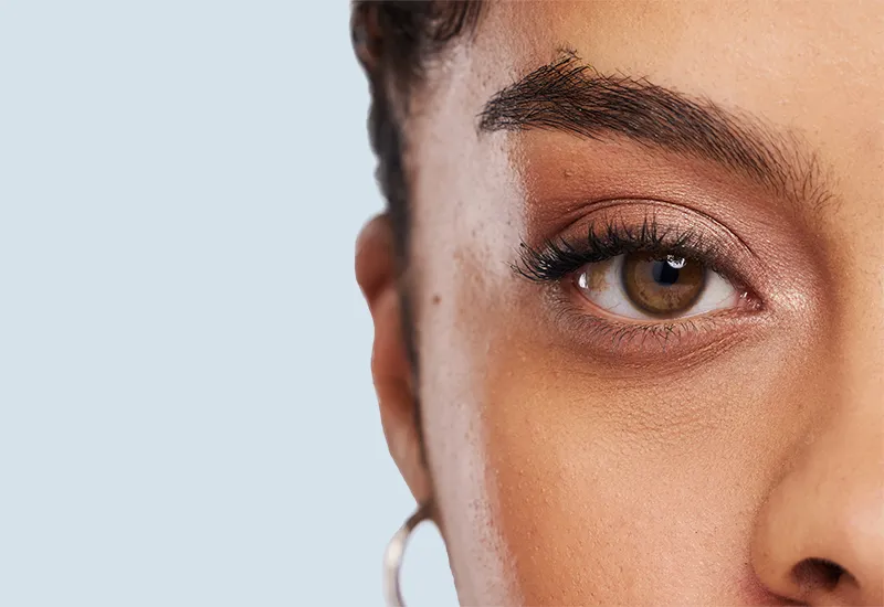 Undereye-Circles